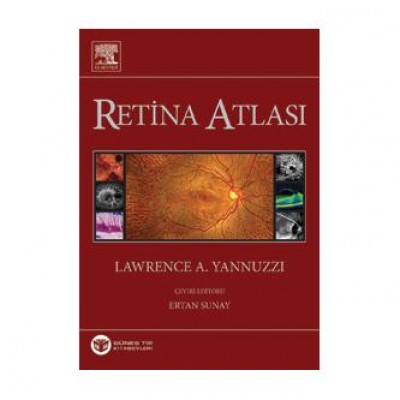 Yannuzzi Retina Atlası,Türkçe 2013 Baskı