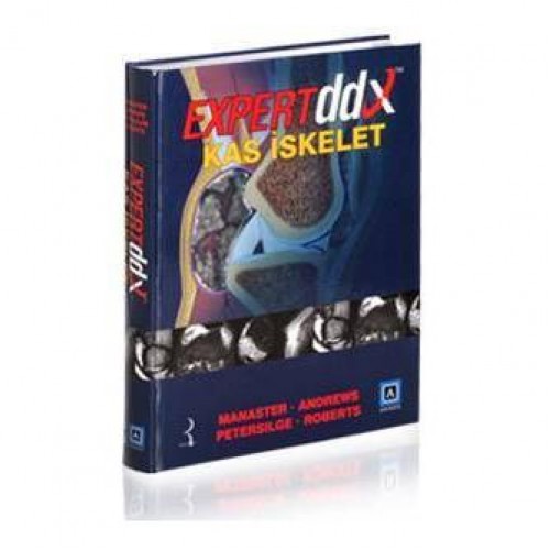 Expert DDX Kas İskelet Expert DDX Kas İskelet
