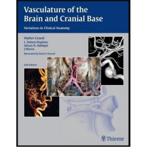Vasculature of the Brain and Cranial Base 2nd Edition