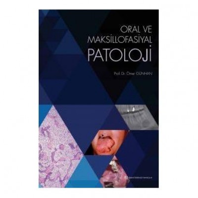 Oral ve Maksillofasiyal Patoloji