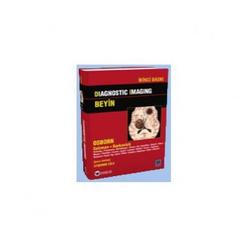 Diagnostic Imaging - Beyin, Türkçe 2013 Baskı Diagnostic Imaging - Beyin, Türkçe 2013 Baskı