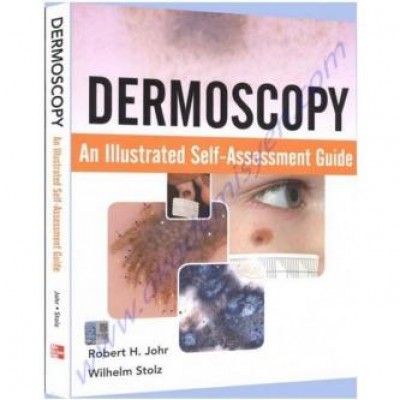 Dermoscopy An Illustrated Self-Assessment Guide