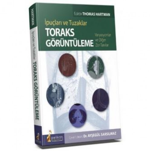 İpuçları ve Tuzaklar Toraks Görüntüleme Varyasyonlar ve Diğer Zor Tanılar