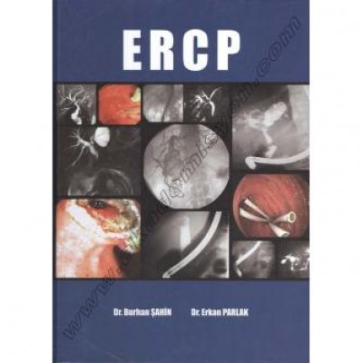 ERCP