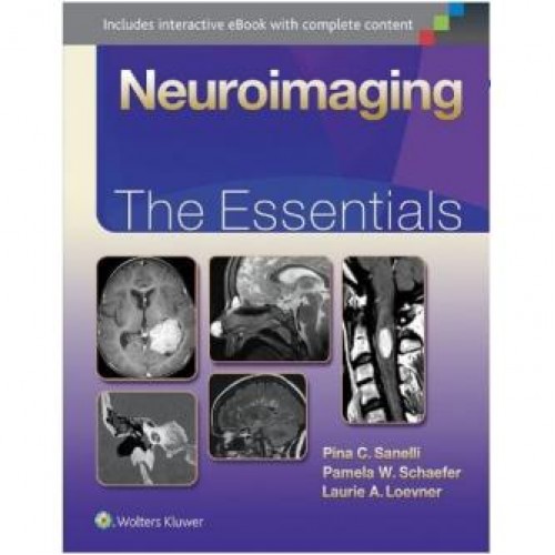 Neuroimaging: The Essentials Neuroimaging: The Essentials