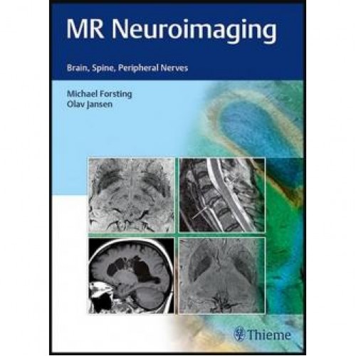 MR Neuroimaging: Brain, Spine, and Peripheral Nerves 1st Edition