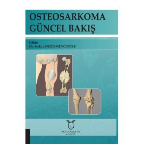 Osteosarkoma Güncel Bakış Osteosarkoma Güncel Bakış