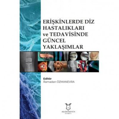 Erişkinlerde Diz Hastalıkları ve Tedavisinde GÜNCEL YAKLAŞIMLAR