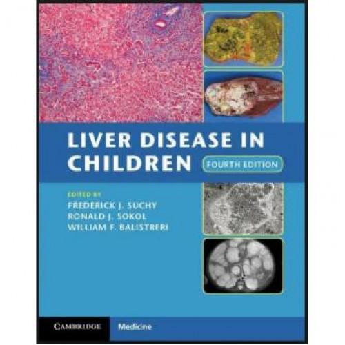 Liver Disease in Children