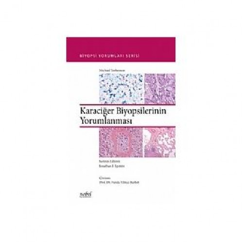Karaciğer Biyopsilerinin Yorumlanması Biyopsi Yorumları Serisi