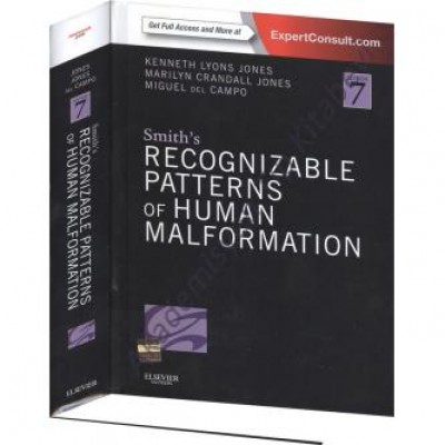 Smith's Recognizable Patterns of Human Malformation, 7th Edition