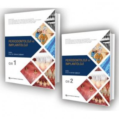 Periodontoloji ve İmplantoloji - Cilt 1 ve 2