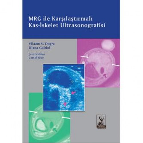 MRG İle Karşılaştırmalı Kas-İskelet Ultrasonografisi