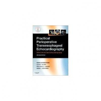 Practical Perioperative Transesophageal Echocardiography,