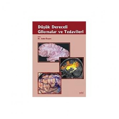 Düşük Dereceli Gliomalar ve Tedavileri