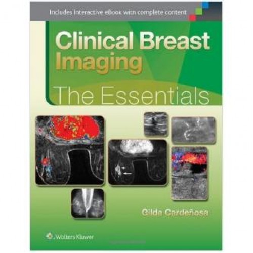 Clinical Breast Imaging: The Essentials