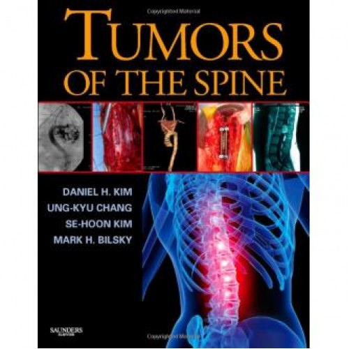 Tumors of the Spine Tumors of the Spine
