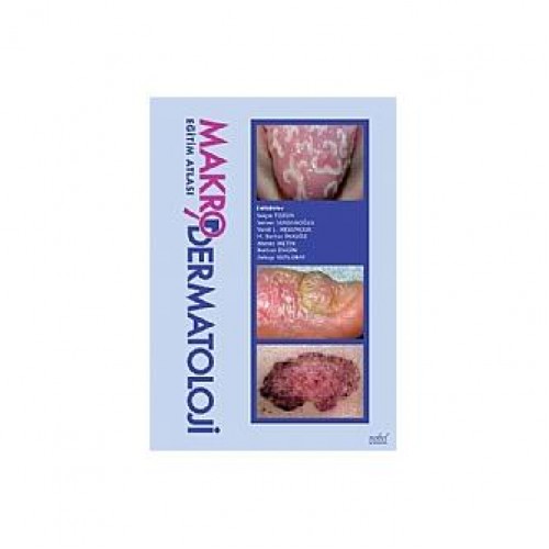 Makro Dermatoloji Eğitim Atlası