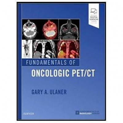 Fundamentals of Oncologic PET/CT (Fundamentals of Radiology) 1st Edition