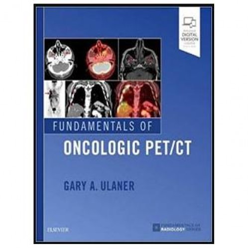 Fundamentals of Oncologic PET/CT (Fundamentals of Radiology) 1st Edition