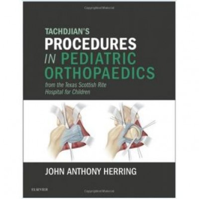 Tachdjian's Procedures in Pediatric Orthopaedics: From the Texas Scottish Rite Hospital for Children, 1e