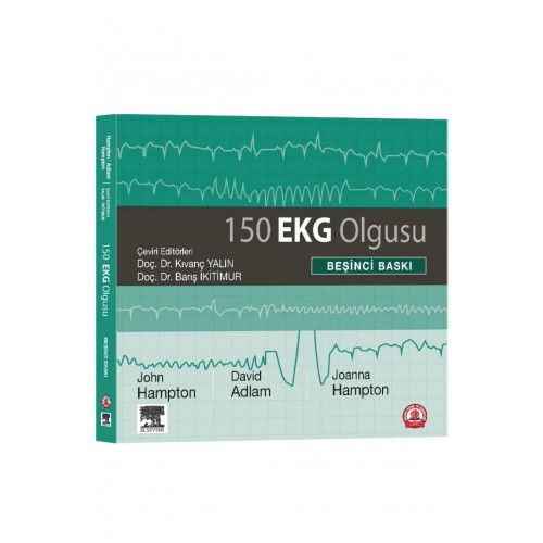 150 EKG Olgusu