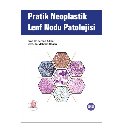 Pratik Neoplastik Lenf Nodu Patolojisi