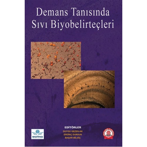 Demans Tanısında Sıvı Biyobelirteçler