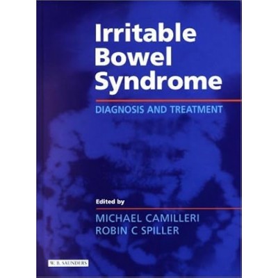 Irritable Bowel Syndrome: Diagnosis and Treatment