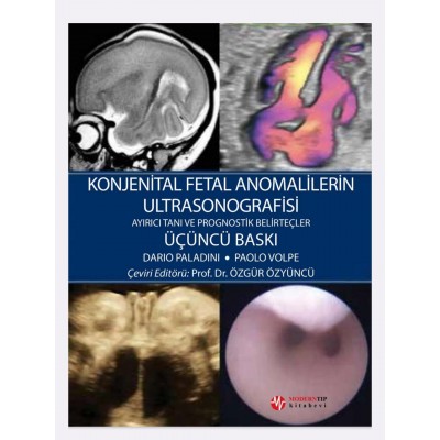 Konjenital Fetal Anomalilerin Ultrasonografisi