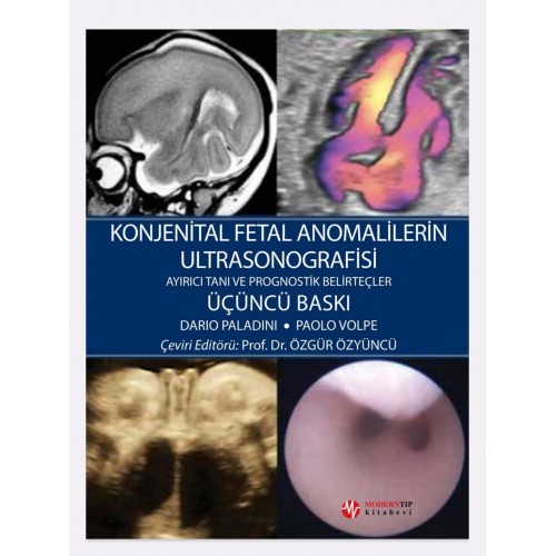 Konjenital Fetal Anomalilerin Ultrasonografisi