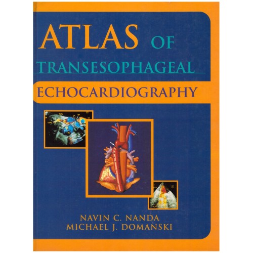 Atlas of Transesophageal Echocardiography
