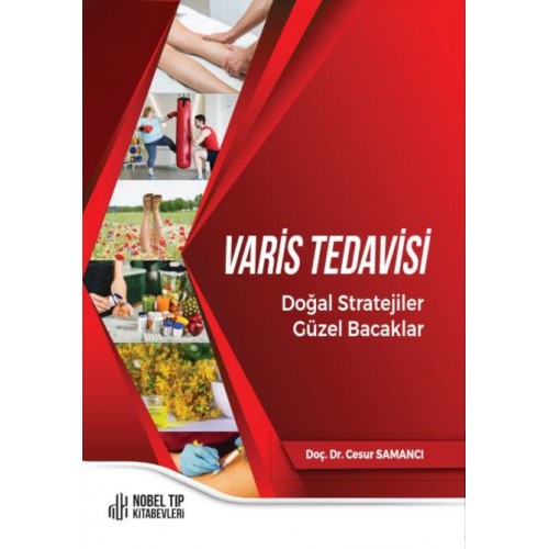Varis Tedavisi Doğal Stratejiler,Güzel Bacaklar